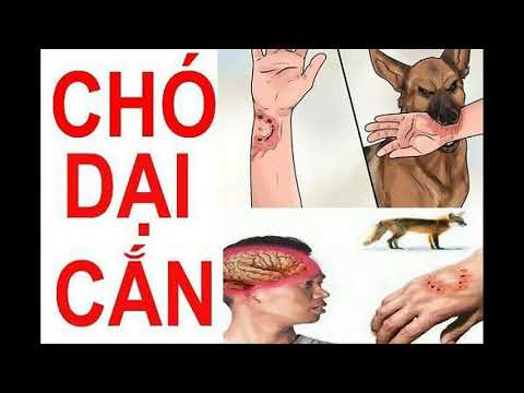 Xử trí vết thương khi bị cho cắn